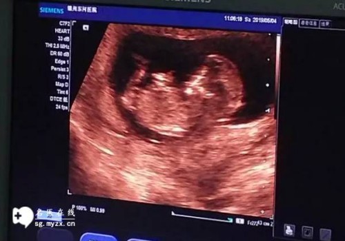 2023年徐州第一人民醫(yī)院試管嬰兒攻略，內(nèi)附成功率與費(fèi)用構(gòu)成！_1