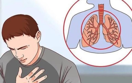 剖宮產(chǎn)后收腹帶需要戴多久？附佩戴時間及注意事項_1