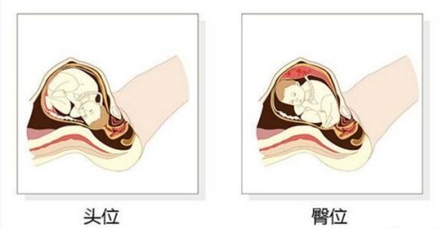 過來人分享艾灸治療月經(jīng)不調(diào)的效果，好不好一看便知