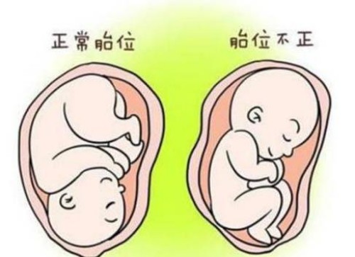 寧波助孕：三代篩查不合格仍然想要移植？能夠接受這些風(fēng)險(xiǎn)就可以繼續(xù)