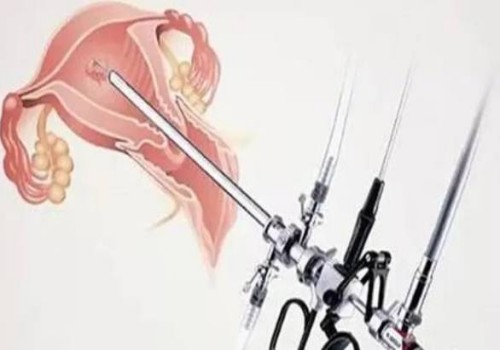 單身女性不要只看凍卵的利端，只要是手術(shù)就會有利弊