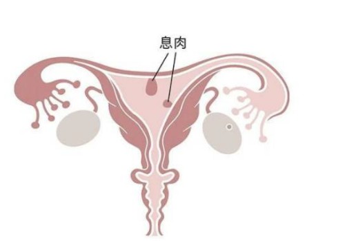 寧波正規(guī)助孕機構(gòu)：睪丸越多生育能力越強不可信，多睪癥有什么危害